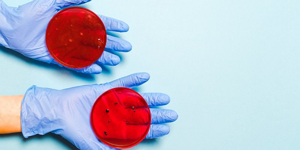 YOUR QUESTIONS ABOUT COVID-19 (THE CORONAVIRUS) ANSWERED